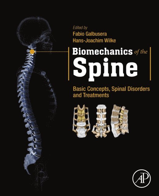 Hans-Joachim Wilke, Fabio Galbusera - Biomechanics of the Spine, E-bok