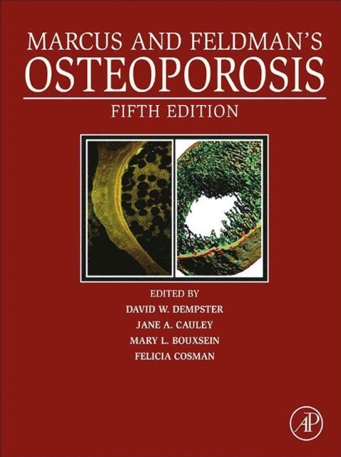 Felicia Cosman, Mary L. Bouxsein, Jane A. Cauley, David W. Dempster - Marcus and Feldman's Osteoporosis, E-bok