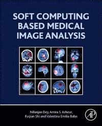 Soft Computing Based Medical Image Analysis