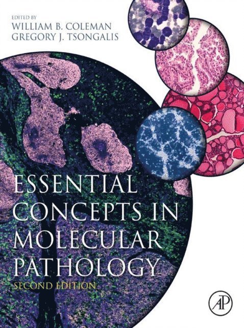 Gregory J. Tsongalis, William B. Coleman - Essential Concepts in Molecular Pathology, E-bok
