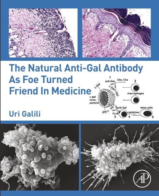 Uri Galili - Natural Anti-Gal Antibody as Foe Turned Friend in Medicine, E-bok