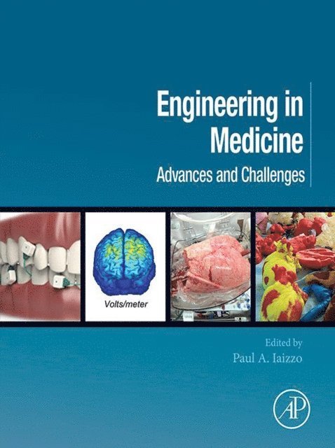 Paul A. Iaizzo - Engineering in Medicine, E-bok