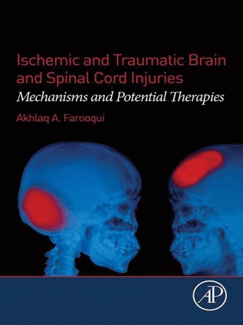 Akhlaq A. Farooqui - Ischemic and Traumatic Brain and Spinal Cord Injuries, E-bok