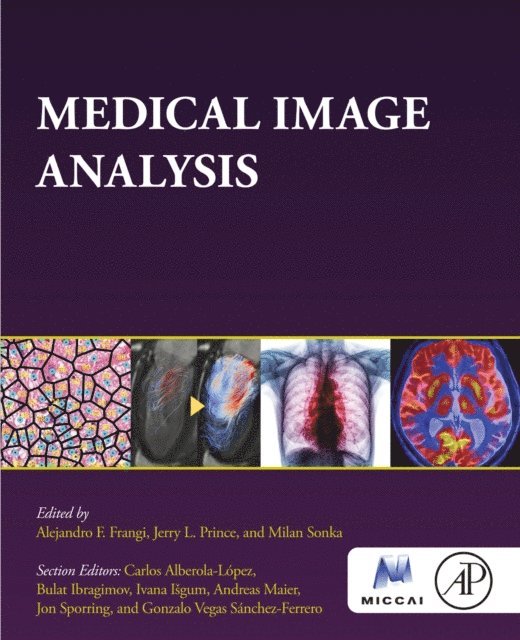 Milan Sonka, Jerry Prince, Alejandro Frangi - Medical Image Analysis, E-bok