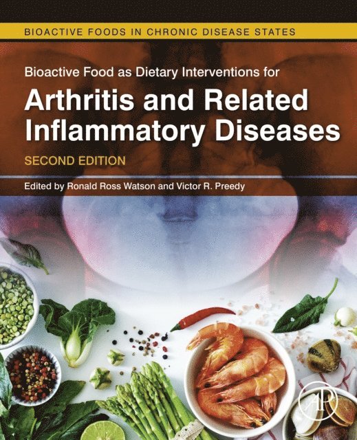 Victor R Preedy, Ronald Ross Watson - Bioactive Food as Dietary Interventions for Arthritis and Related Inflammatory Diseases, E-bok