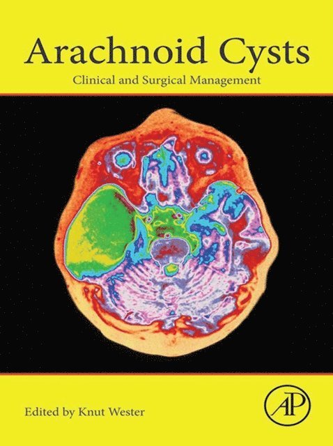 Knut Wester - Arachnoid Cysts, E-bok