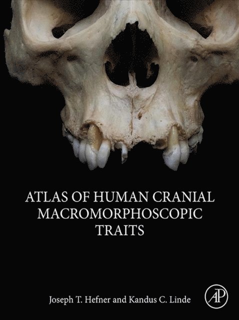 Kandus C. Linde, Joseph T. Hefner - Atlas of Human Cranial Macromorphoscopic Traits, E-bok