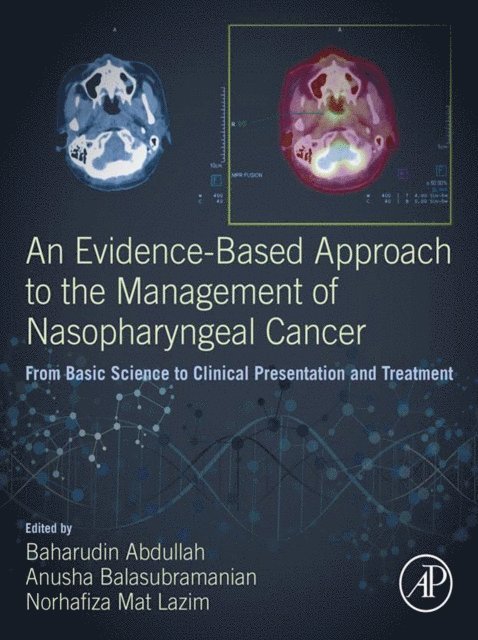 Norhafiza Mat Lazim, Anusha Balasubramanian, Baharudin Abdullah - Evidence-Based Approach to the Management of Nasopharyngeal Cancer, E-bok