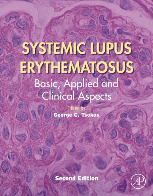 George C. Tsokos - Systemic Lupus Erythematosus, E-bok