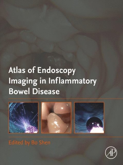 Bo Shen - Atlas of Endoscopy Imaging in Inflammatory Bowel Disease, E-bok