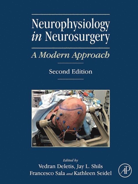 Kathleen Seidel, Francesco Sala, Jay L. Shils, Vedran Deletis - Neurophysiology in Neurosurgery, E-bok