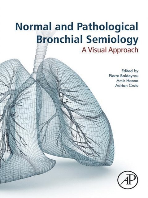Adrian Crutu, Amir Hanna, Pierre Philippe Baldeyrou - Normal and Pathological Bronchial Semiology, E-bok. Tillgänglighet: Lägg i varukorg
