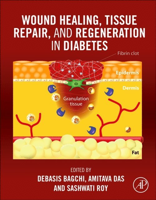 Sashwati Roy, Amitava Das, Debasis Bagchi - Wound Healing, Tissue Repair, and Regeneration in Diabetes, E-bok