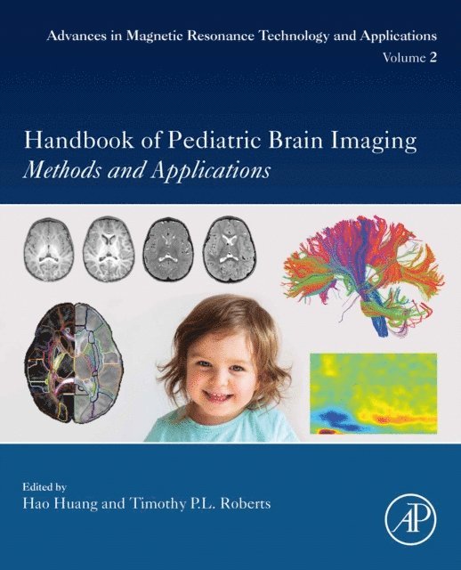 Timothy Roberts, Hao Huang - Handbook of Pediatric Brain Imaging, E-bok