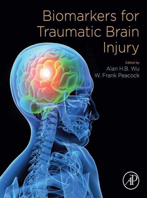W. Frank Peacock, Alan H.B. Wu - Biomarkers for Traumatic Brain Injury, E-bok