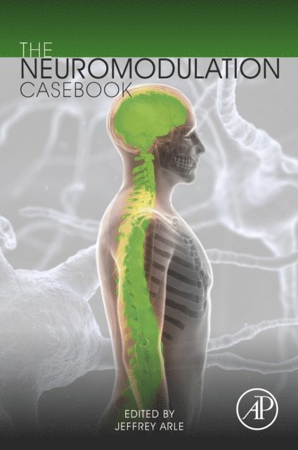 Jeffrey Arle - Neuromodulation Casebook, E-bok