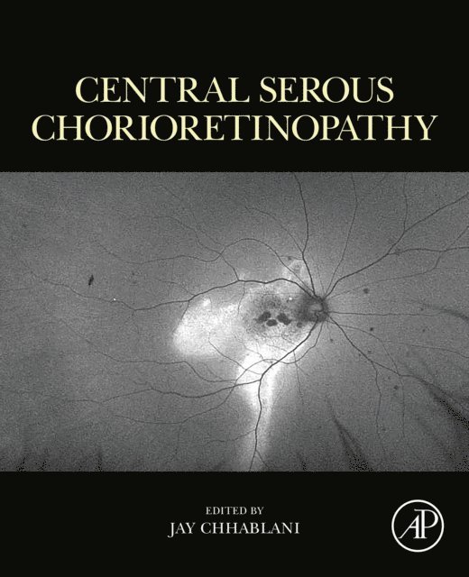 Jay Chhablani - Central Serous Chorioretinopathy, E-bok