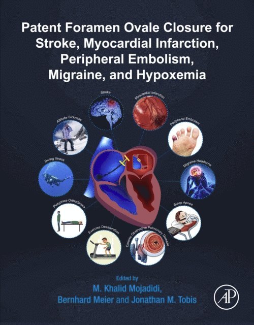 Jonathan M. Tobis, Bernhard Meier, M. Khalid Mojadidi - Patent Foramen Ovale Closure for Stroke, Myocardial Infarction, Peripheral Embolism, Migraine, and Hypoxemia, E-bok