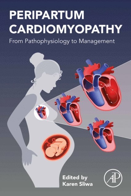 Karen Sliwa - Peripartum Cardiomyopathy, E-bok