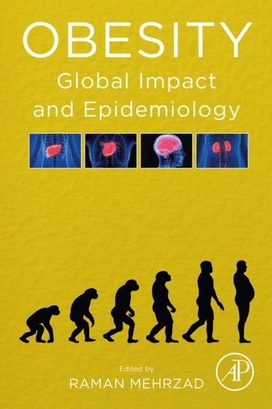 Raman Mehrzad - Obesity, E-bok