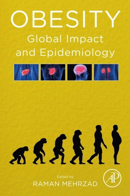 Raman Mehrzad - Obesity, E-bok