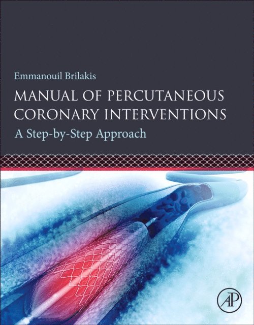 Emmanouil Brilakis - Manual of Percutaneous Coronary Interventions, E-bok. Tillgänglighet: Lägg i varukorg