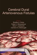 Cerebral Dural Arteriovenous Fistulas