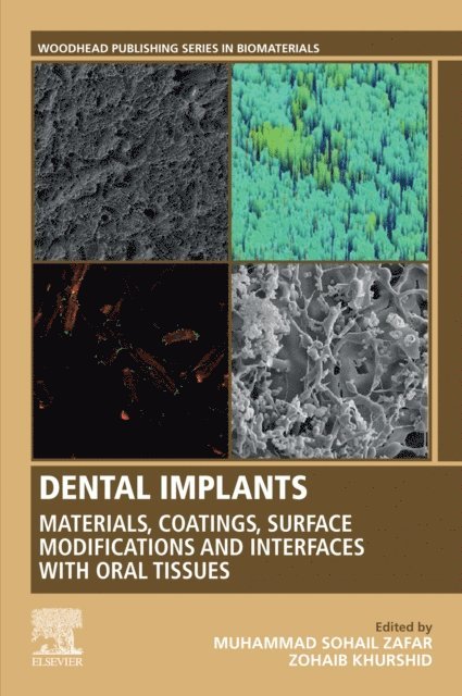 Zohaib Khurshid, Muhammad Zafar - Dental Implants, E-bok