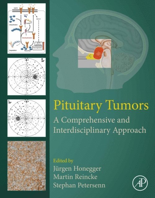 Stephan Petersenn, Martin Reincke, Jurgen Honegger - Pituitary Tumors, E-bok. Tillgänglighet: Lägg i varukorg