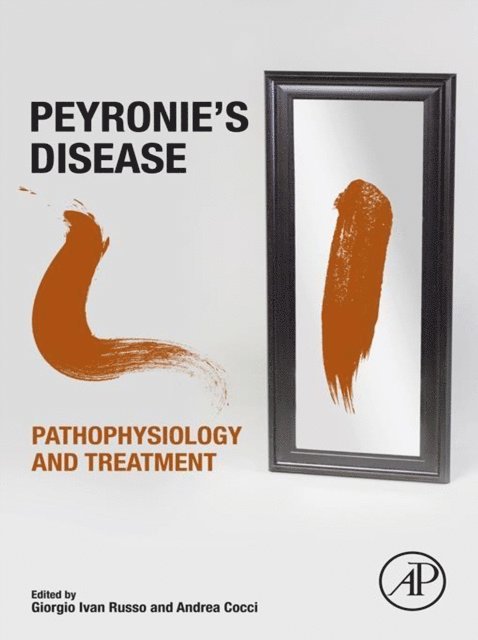 Andrea Cocci, Giorgio Ivan Russo - Peyronie's Disease: Pathophysiology and Treatment, E-bok