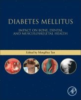 Meng Hee Tan - Diabetes Mellitus, Häftad