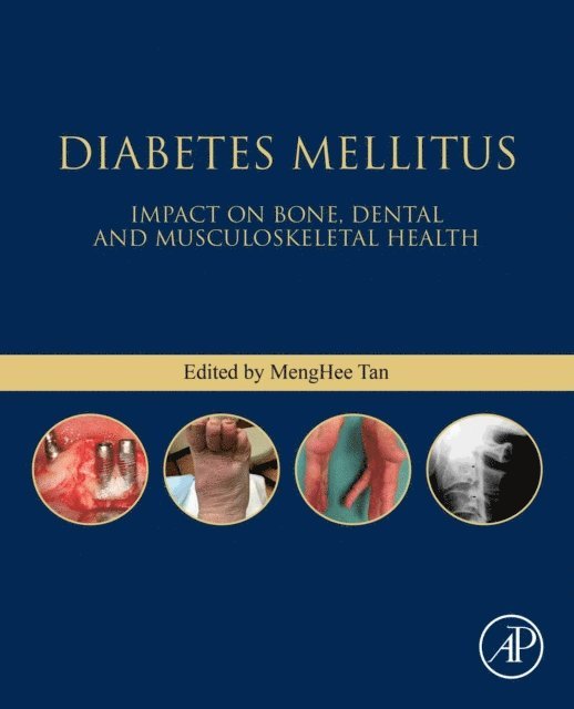Meng Hee Tan - Diabetes Mellitus, E-bok