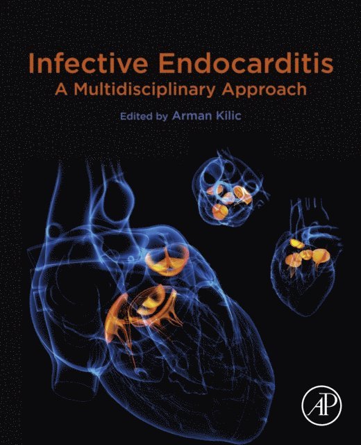 Arman Kilic - Infective Endocarditis, E-bok