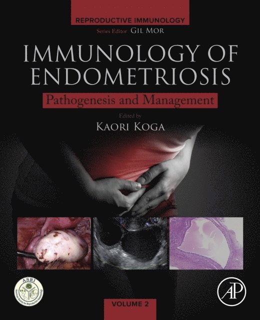 Kaori Koga - Immunology of Endometriosis, E-bok