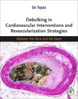 On Topaz - Debulking in Cardiovascular Interventions and Revascularization Strategies, Häftad. Tillgänglighet: Lägg i varukorg