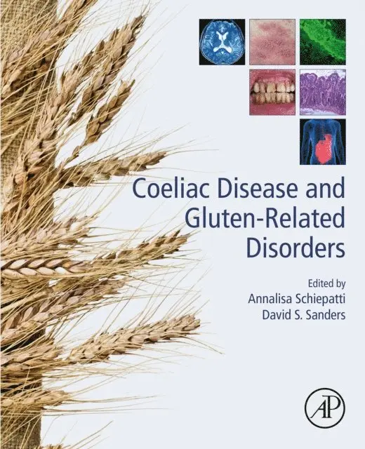 David S. Sanders, Annalisa Schiepatti - Coeliac Disease and Gluten-Related Disorders, E-bok. Tillgänglighet: Lägg i varukorg