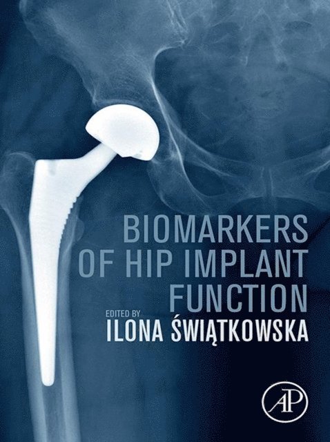Ilona Swiatkowska - Biomarkers of Hip Implant Function, E-bok. Tillgänglighet: Lägg i varukorg