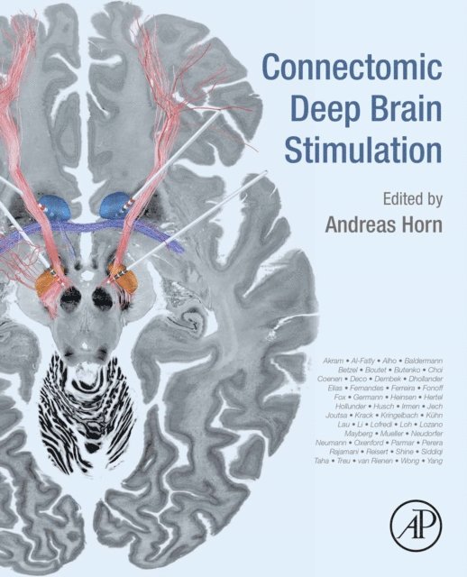 Andreas Horn - Connectomic Deep Brain Stimulation, E-bok