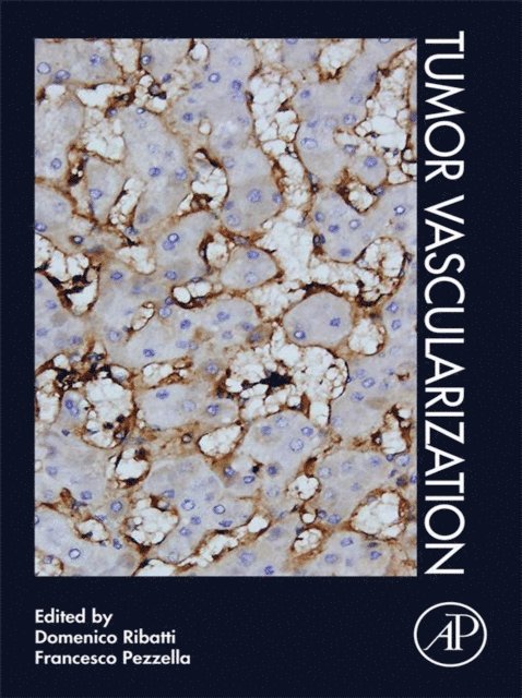 Francesco Pezzella, Domenico Ribatti - Tumor Vascularization, E-bok