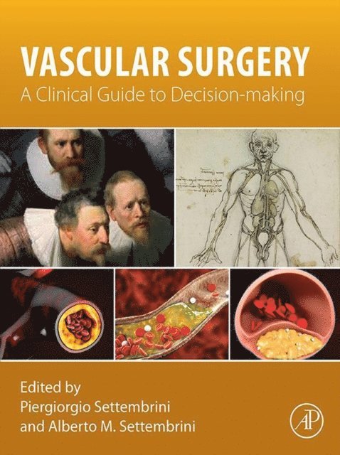 Alberto M. Settembrini, Piergiorgio Settembrini - Vascular Surgery, E-bok