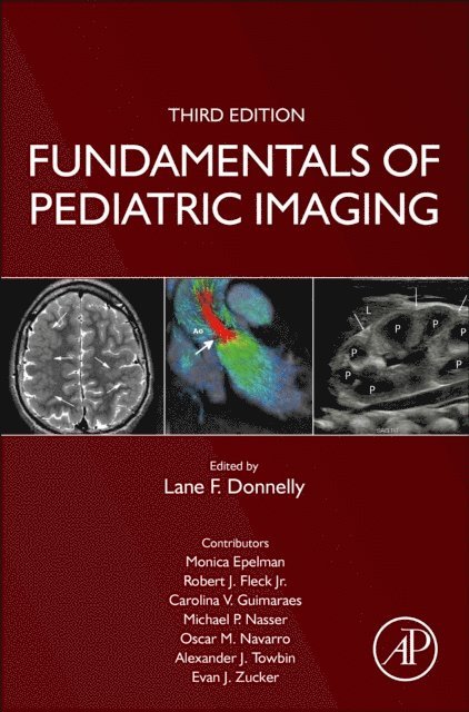 Lane F. Donnelly - Fundamentals of Pediatric Imaging, E-bok