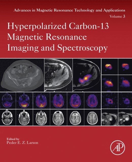 Peder Larson - Hyperpolarized Carbon-13 Magnetic Resonance Imaging and Spectroscopy, E-bok