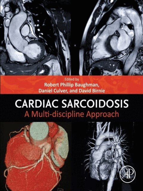 David Birnie, Daniel Culver, Robert Phillip Baughman - Cardiac Sarcoidosis, E-bok
