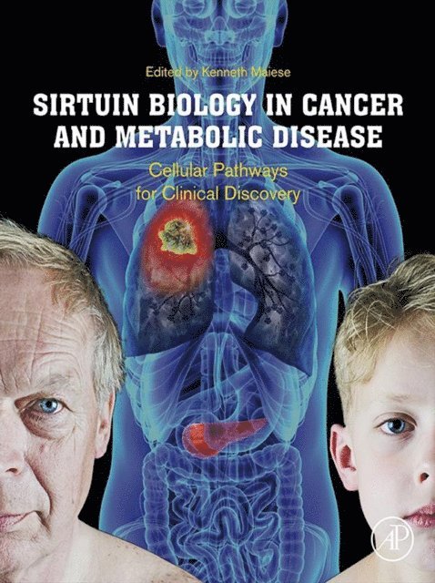 Kenneth Maiese - Sirtuin Biology in Cancer and Metabolic Disease, E-bok