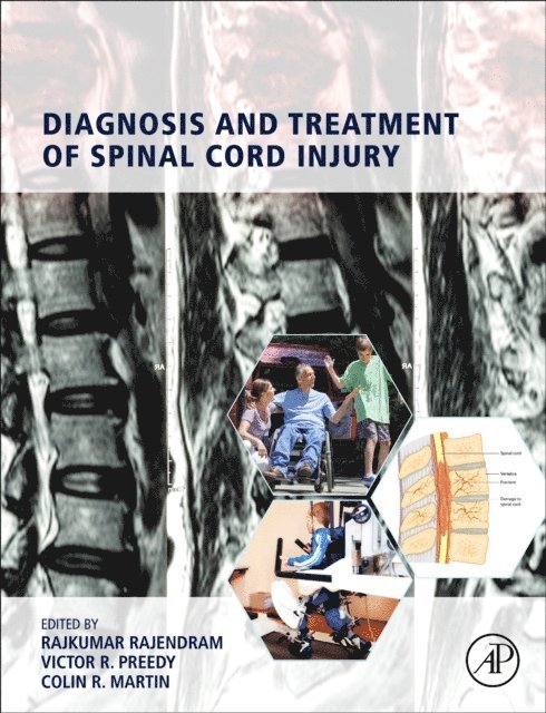 Colin R. Martin, Victor R. Preedy, Rajkumar Rajendram - Diagnosis and Treatment of Spinal Cord Injury, E-bok