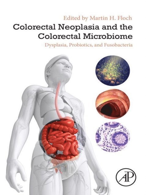 Martin H. Floch - Colorectal Neoplasia and the Colorectal Microbiome, E-bok