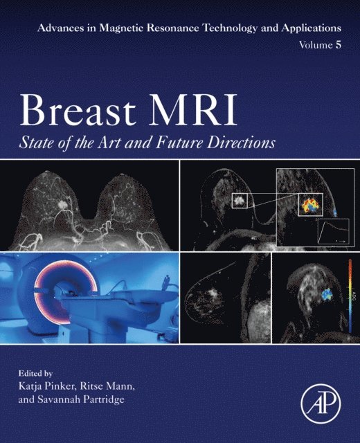 Savannah Partridge, Ritse Mann, Katja Pinker - Breast MRI, E-bok