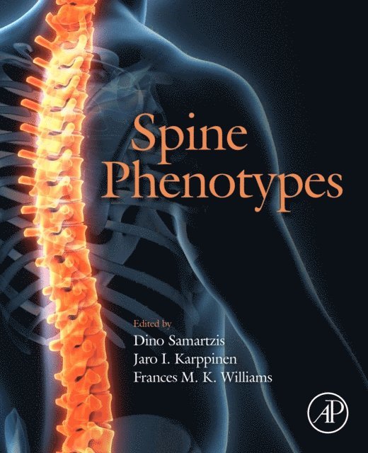 Frances M.K. Williams, Jaro I. Karppinen, Dino Samartzis - Spine Phenotypes, E-bok