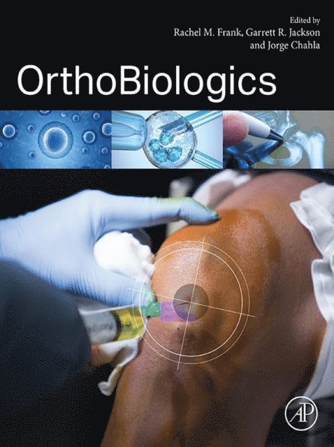 Garrett Jackson, Jorge Chahla, Rachel M. Frank - OrthoBiologics, E-bok