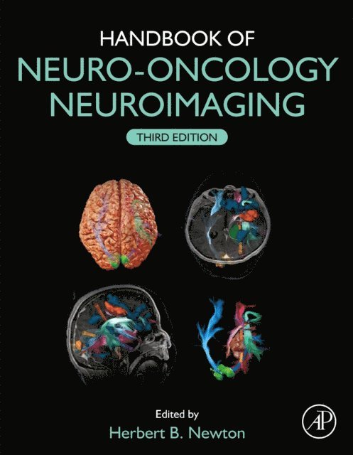 Herbert B. Newton - Handbook of Neuro-Oncology Neuroimaging, E-bok
